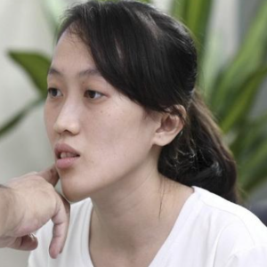 mat-lech-do-dau-cach-khac-phuc-va-cai-thien-nhanh-chong